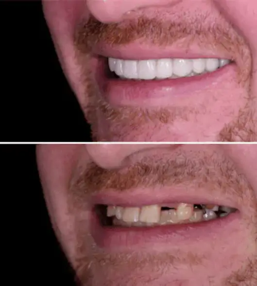 Dental Implants Smile in Norwalk, CT