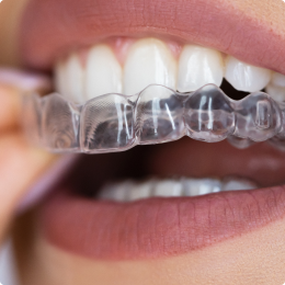 Straighten Your Smile Discreetly With Clear Aligners