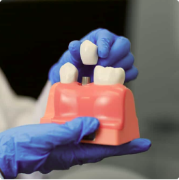 Dental Implant Restorations