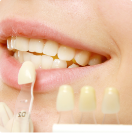 Discreet Tooth-Colored Fillings